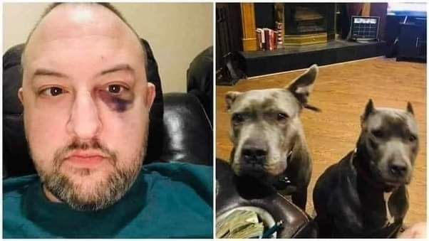 Thursday night, I was sitting in my garage smoking a cigarette. Horrible habit, I know.

4 young men rushed me, decided they wanted my car, beat me up, and wanted my keys. I told them the keys were in the house. They decided to go in.

What they weren’t expecting were my 2 80lb