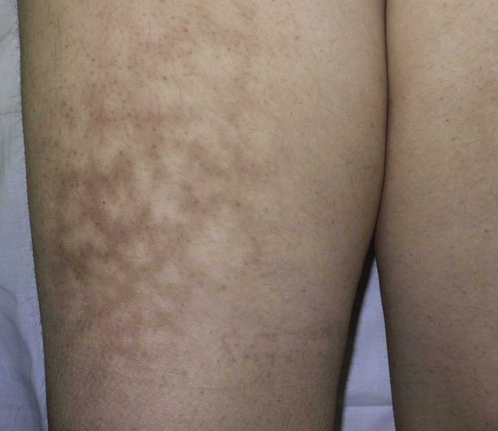 Why you shouldn't put your laptop on your lap... 
A thread ⬇️