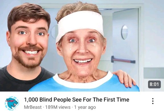 CocoaFox023's tweet photo. He didn't even pay for the surgeries 

Who could've seen it coming that this was just a PR attempt... oh wait a bunch of people did but were booed at https://t.co/5VOQad7LLU