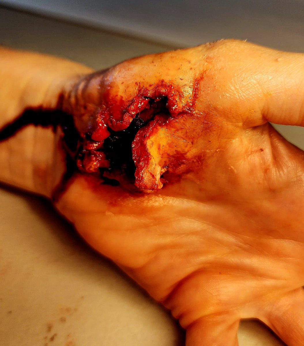 deabea5's tweet photo. LASSERAYSHUUUUNNNN!!!!

I didn't initially plan on doing any of my shit today but I get bored easily, so. 
🤷‍♀️

#vfx #vfxmakeup #sfx #amateurartist #practicepracticepractice #trialanderror #injury https://t.co/Saure2wCzV