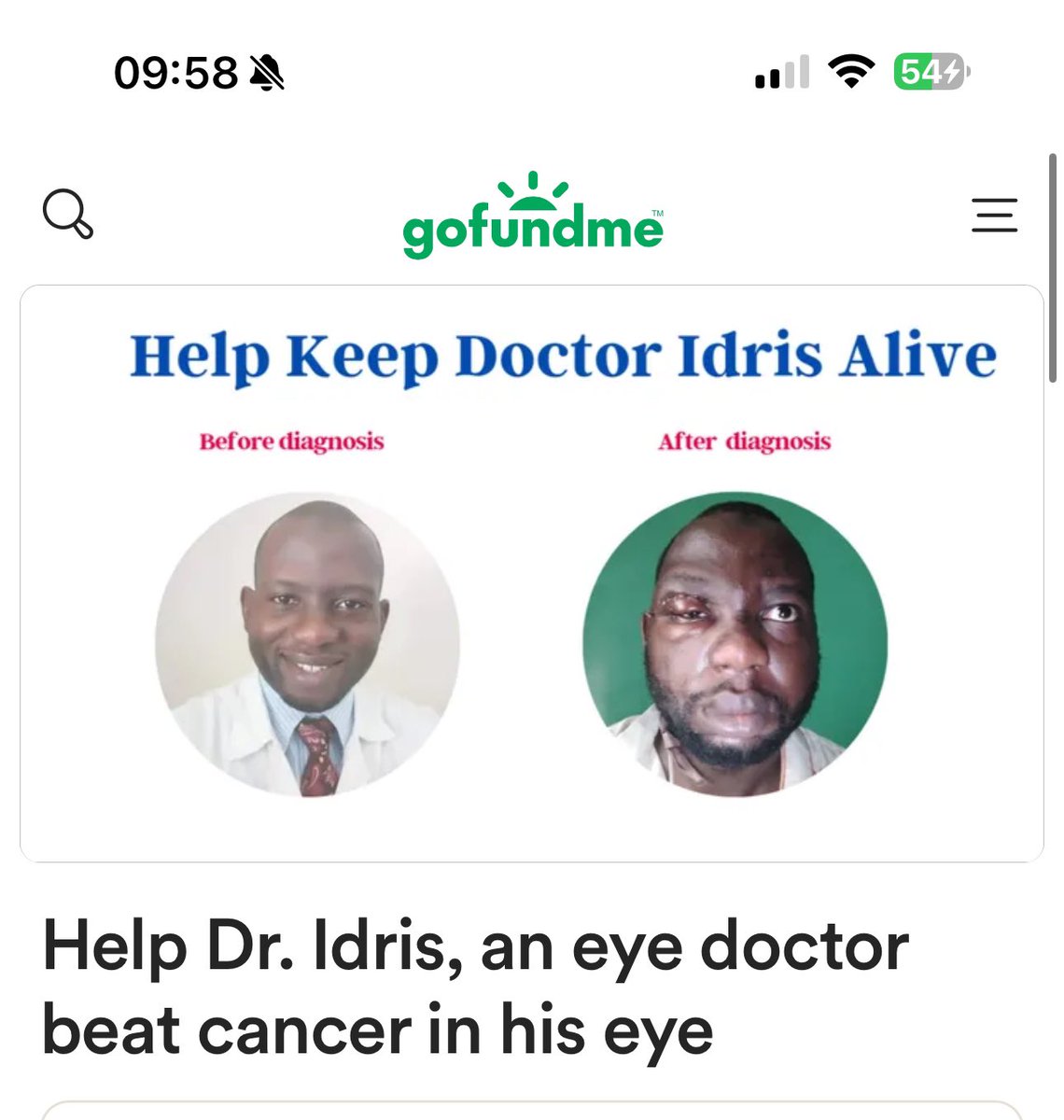 OurFavOnlineDoc's tweet photo. URGENT CALL FOR HELP:
I’ve just read the sad story of a young nigerian medical doctor and eye specialist Dr. Idris, who has sadly developed eye cancer. He needs our help to save his life and save his eyes if possible.

Dr Idris is a graduate of the College of Medicine, Ibadan. He is a brilliant young ophthalmologist who has dedicated his life to giving sight back to thousands of people in need.

Tragically, he developed concerning symptoms in his own eyes, and now faces a life-altering diagnosis: a very rare, deadly eye cancer that threatens not only his own vision but his very life - the diagnosis is a malignant melanoma of the lacrimal gland.

He has undergone one surgery and has received 3 doses of immunotherapy so far, costing over 13 million naira, yet t bye  disease is rapidly progressing & he needs urgent specialized treatment overseas- further surgery, immunotherapy & radiotherapy. This comes at an overwhelming cost - $150,000, an unimaginable amount, far beyond his salary or reach in a developing country.

Despite the challenges, Idris is resilient and determined to beat this disease. Friends, Idris needs us. Let’s show him the power of community by helping him access this life-saving treatment. He has a wife and 3 beautiful kids!

Every contribution makes a difference! Please donate, share, and spread the word.

Donations in Naira can be made to:
0042546426
OLAJIDE Idris Olawumi
Union Bank

For more info, contact siblings: +2348079574748, +2348138332485

I have also put the gofundme account.

Every little amount counts.
100naira, 500Naira, 1,000naira, 
Please anything you have, kindly help us to #SaveDrIdrisEyes #HelpSaveDrIdris

It only takes 2seconds to retweet.
Please I beg you all. If you see this, kindly retweet. You never know who can help.

https://t.co/4Mfte5TMJl
