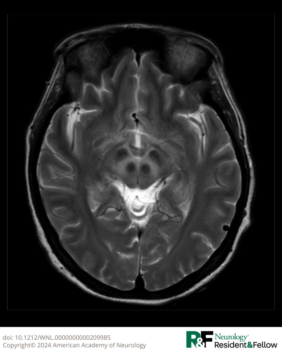 Neurology Journal tweet media