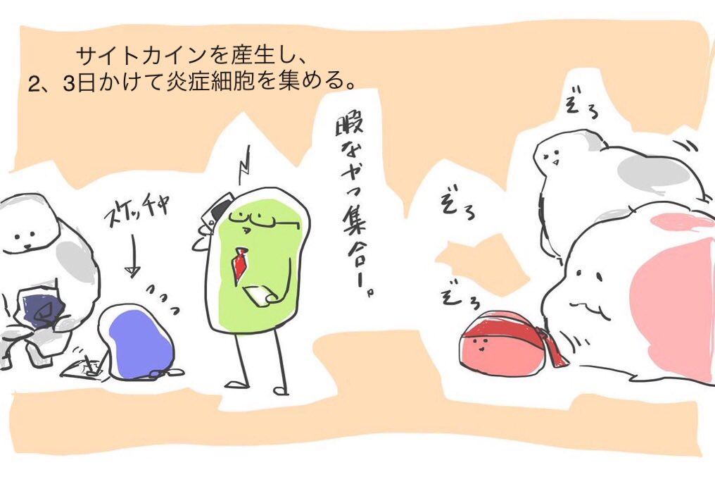 独断と偏見まみれのアレルギーⅣ型💨

※学生の時に描いたものなので、間違ってたら是非リプ欄でご指摘ご指導お願いします。 