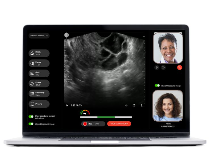 🌟Dive into our cutting-edge research! Discover the publication on the Pulsenmore transvaginal #ultrasound for monitoring ovarian stimulation in ART, authored by Yoel Shufaro and the team at Beilinson - Rabin Medical Center.
Find the link to the publication in the first comment