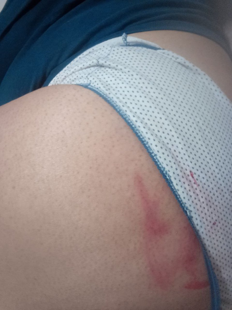 _mujer_de_'s tweet photo. Mientras se recibe familia y se hace vida normal, en el baño me limpio y maquillo para tapar lo que se pueda, #asuspies https://t.co/kAK2ZgJW0Y