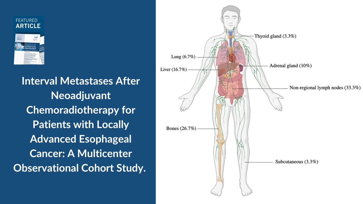 Society of Surgical Oncology (@socsurgonc) on Twitter photo Metastases develop in 10% of esophageal cancer patients post-neoadjuvant chemoradiotherapy. Restaging may identify candidates for curative treatment, improving survival outcomes. Read more in <a href="/AnnSurgOncol/">Annals of Surgical Oncology</a>: ow.ly/Cam650TY7li #FeaturedArticle Metastases develop in 10% of esophageal cancer patients post-neoadjuvant chemoradiotherapy. Restaging may identify candidates for curative treatment, improving survival outcomes. Read more in <a href="/AnnSurgOncol/">Annals of Surgical Oncology</a>: ow.ly/Cam650TY7li #FeaturedArticle