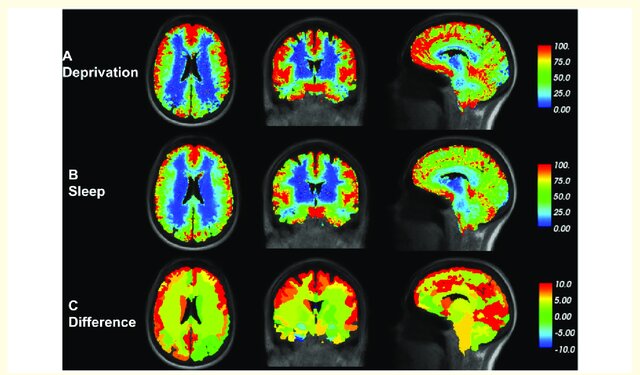 Andrew Huberman once said:

"Don't ask how people are doing, ask how they're sleeping. You'll a lot more"

Poor sleep is the reason you're depressed, have mood swings, and can't focus.

Here are 7 ways to get high-quality sleep every night (based on science):