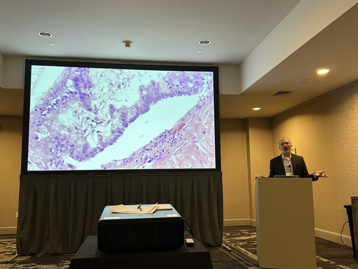 Xuchen Zhang (@zhang_xuchen) on Twitter photo Dr. Joe MIsdraji is presenting appendiceal mucinous neoplasms and PMP at the 2nd day Yale GI Pathology CME course. <a href="/GI/">@GI</a> pathology <a href="/yalepathology/">Yale Pathology</a> <a href="/JosephMisdraji/">Joseph Misdraji</a> Dr. Joe MIsdraji is presenting appendiceal mucinous neoplasms and PMP at the 2nd day Yale GI Pathology CME course. <a href="/GI/">@GI</a> pathology <a href="/yalepathology/">Yale Pathology</a> <a href="/JosephMisdraji/">Joseph Misdraji</a>