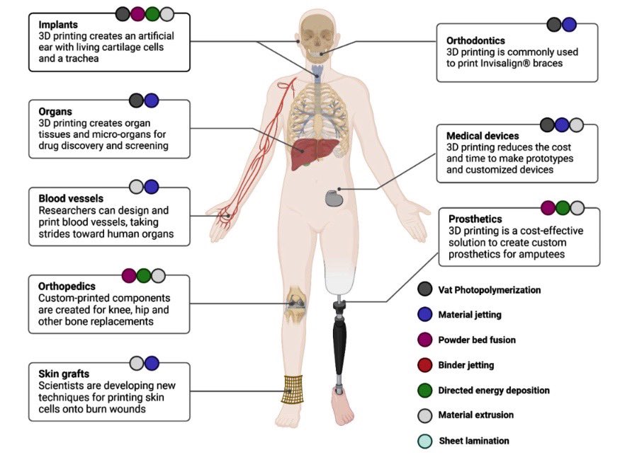 The role of three-dimensional (3D) printing in plastic and reconstructive surgery: innovations and applications.

From 🇮🇳 India!

link.springer.com/article/10.100…