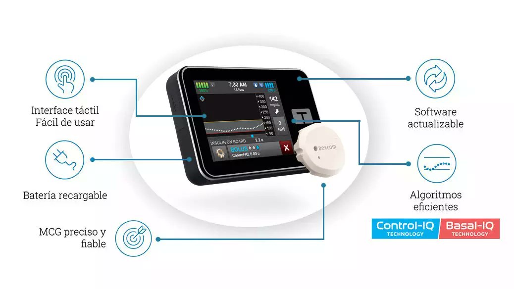 SemergenGTDM's tweet photo. Sistemas automáticos de administración de insulina (páncreas artificial)
Combinan bomba de insulina y sensor de MCG.
Utiliza un algoritmo que ajusta de manera automática la dosis de insulina.
Ejemplos:
#tecnologias #DM #DM2 #diabetes #asacerrada https://t.co/q40UpSKg99