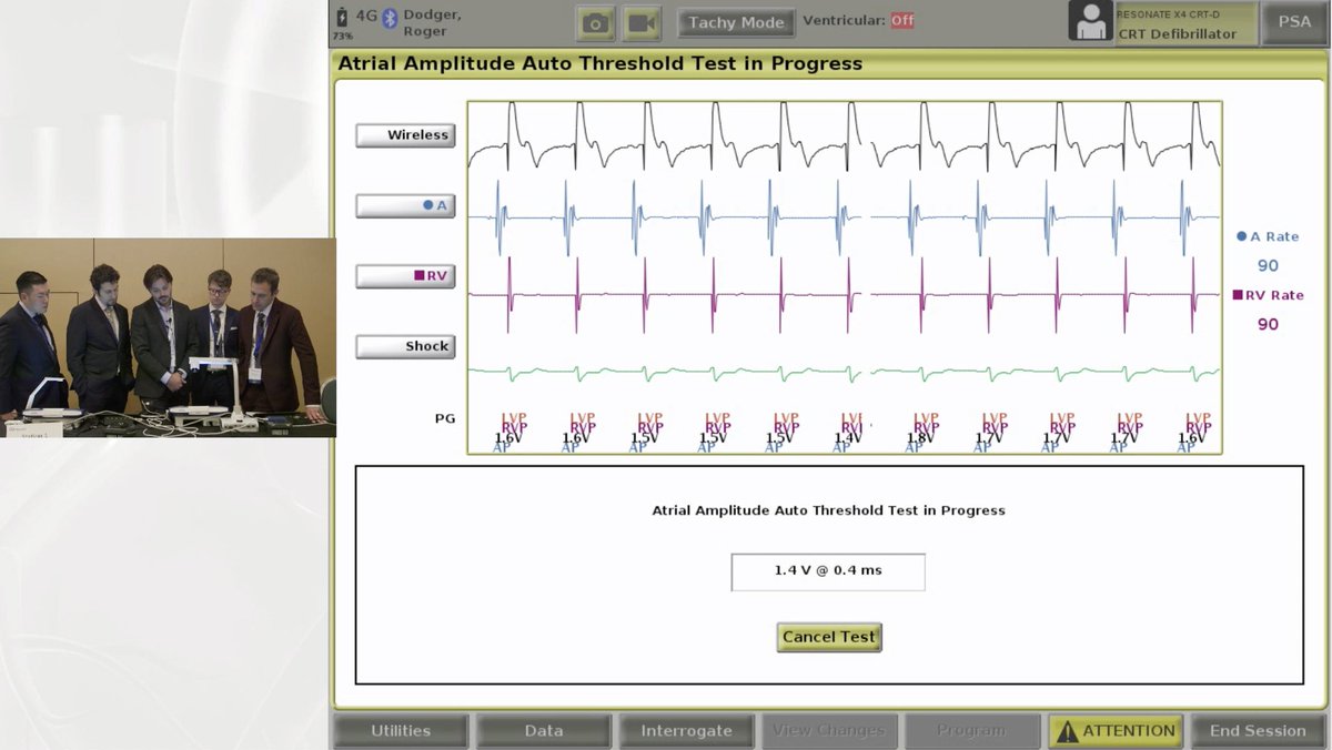 EP Fellows Summit & Arrhythmia Scholars Program (@fellowssummit) on Twitter photo Happening now at the 2024 EP Fellows Summit: Case-based Device Troubleshooting Breakout Workshop.
#Epeeps #cardiotwitter #medtwitter <a href="/True_EP/">William H. Sauer, MD</a> <a href="/Zo_EP2/">ZoEP</a> <a href="/BSCCardiology/">BostonSci Cardiology</a> <a href="/bostonsci/">Boston Scientific</a> <a href="/Medtronic/">Medtronic</a>
Register now to access the complimentary live stream: tinyurl.com/4czax8f2 Happening now at the 2024 EP Fellows Summit: Case-based Device Troubleshooting Breakout Workshop.
#Epeeps #cardiotwitter #medtwitter <a href="/True_EP/">William H. Sauer, MD</a> <a href="/Zo_EP2/">ZoEP</a> <a href="/BSCCardiology/">BostonSci Cardiology</a> <a href="/bostonsci/">Boston Scientific</a> <a href="/Medtronic/">Medtronic</a>
Register now to access the complimentary live stream: tinyurl.com/4czax8f2