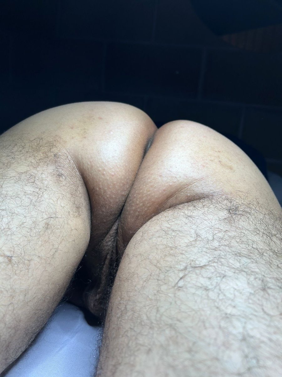 Sugaring CUU tweet media