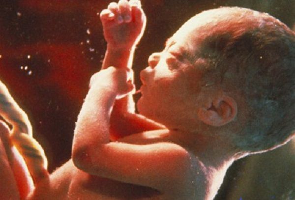 LifeNewsHQ's tweet photo. Vote Against Florida’s Amendment 4, We Can’t Allow Abortions Up to Birth https://t.co/U7pDhpPkMN https://t.co/TXd1OySo8H