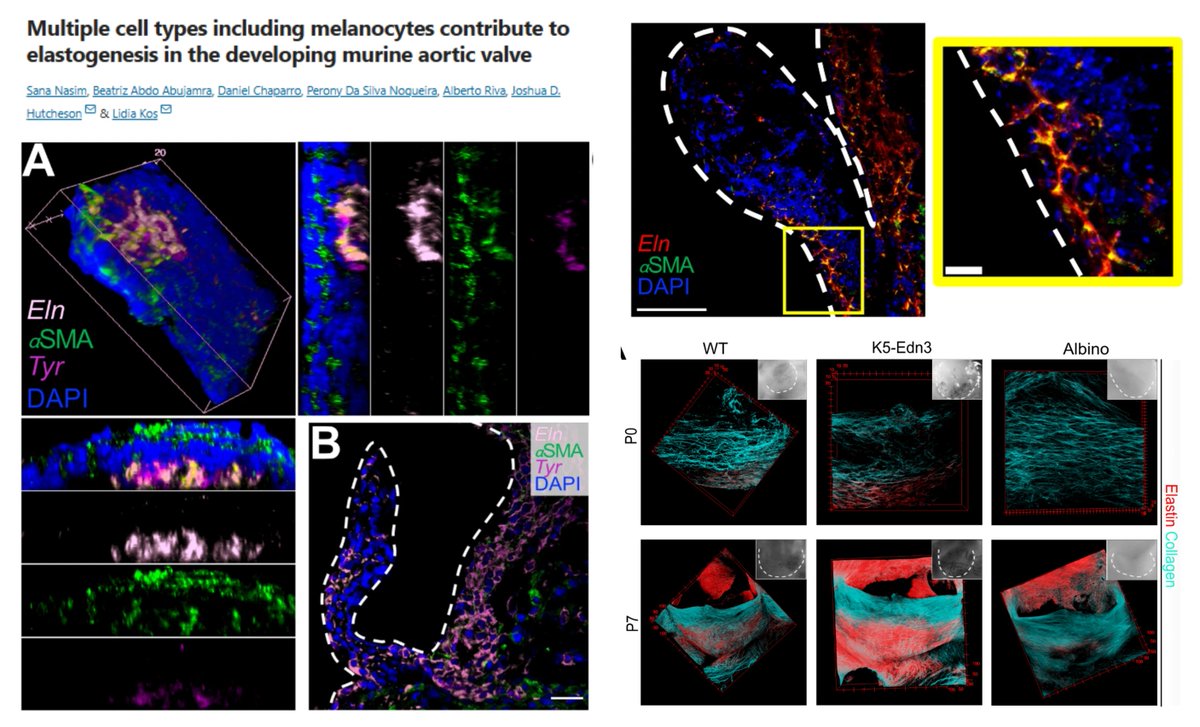 HaoYin20's tweet image. #Valvulogenesis #Elastogenesis #Pigmentation
Melanocyte-like (Acta2+Tyr+) #ValvularInterstitialCell is the major depositor of Elastic Fiber in🐭developing aortic valve
Also, subpopulations of Vim+ interstitial cells or Cdh5+ endothelial cells are elastin-depositing
"In mice,…