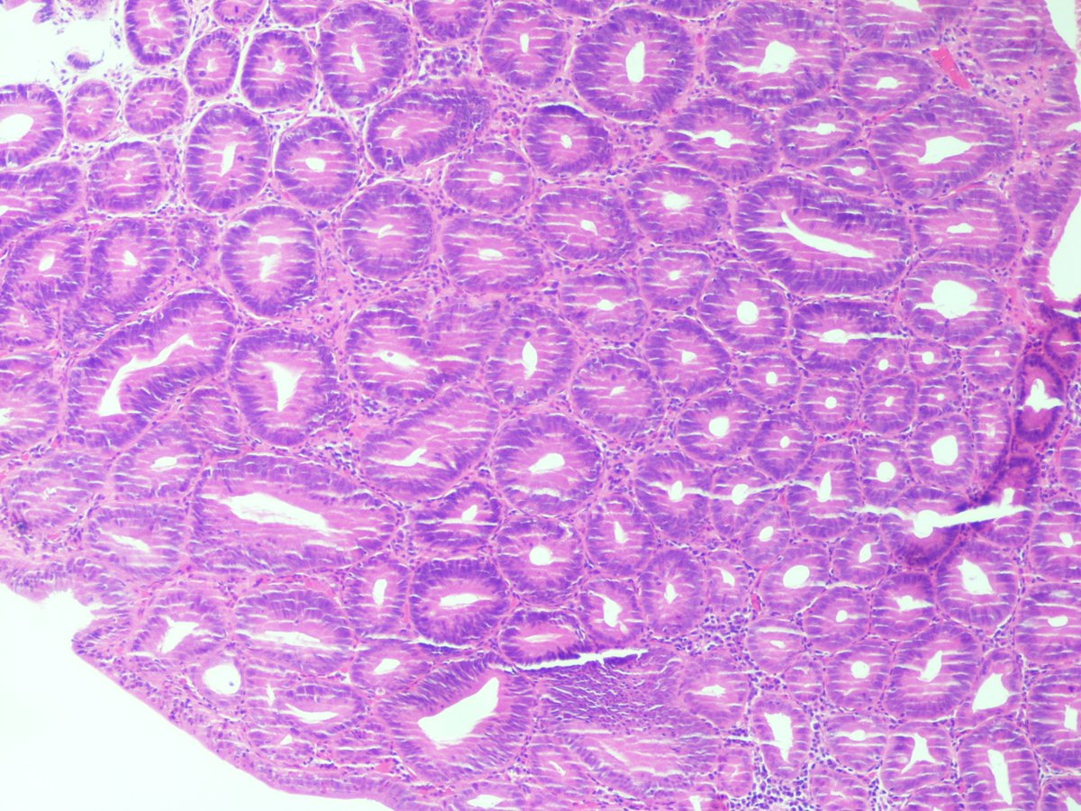 Kenny92954457's tweet image. 1. Organ
2. Dx?