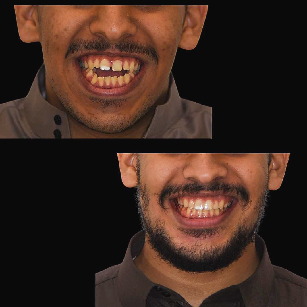 شادي الزهراني tweet media