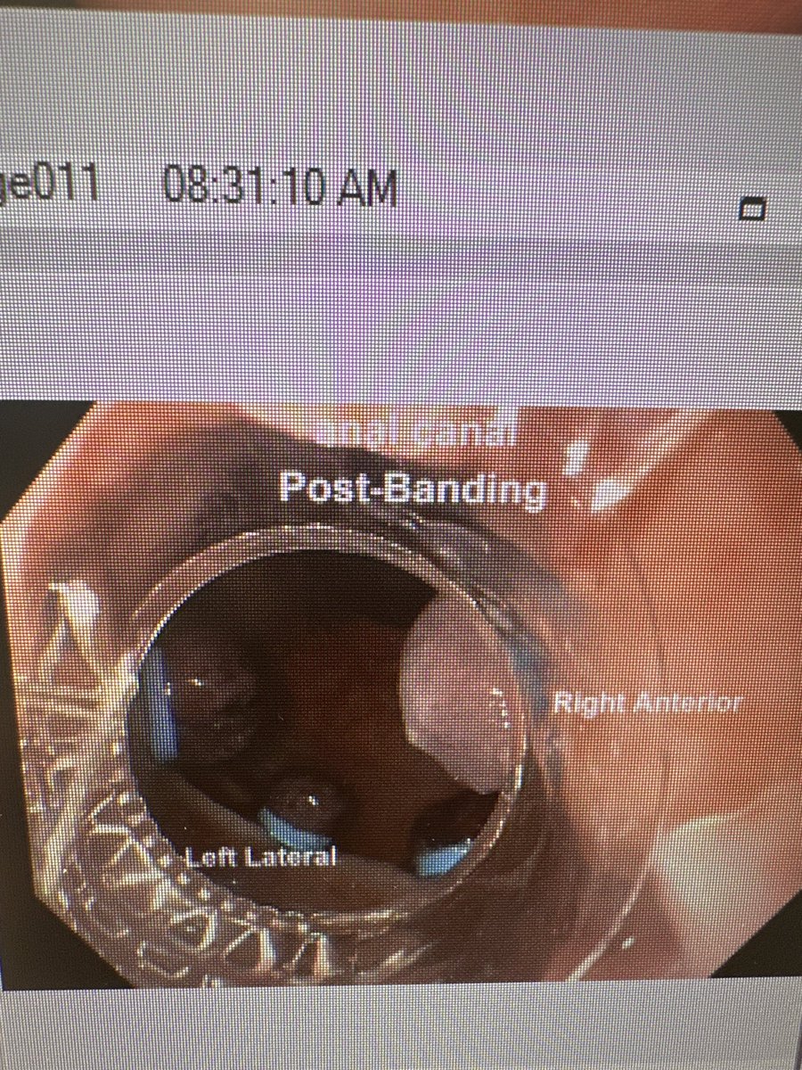 ktswick's tweet photo. @DrBloodandGuts One of my favorite activities! Some of my recent endeavors :) https://t.co/Gcg4ZzADHz