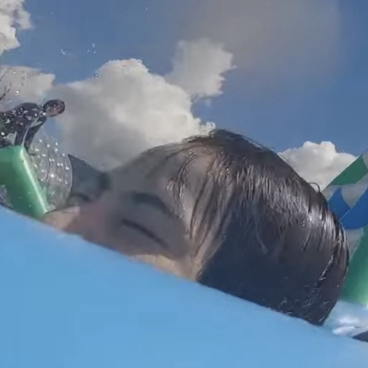 이마에 따콩하구싶어 어캐🐣🥹