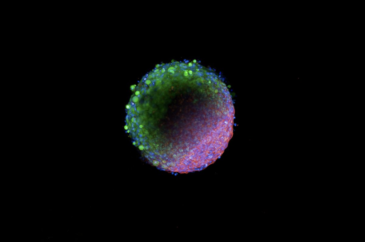 Centre for Drug Discovery Innovation (@sydney_ddi) on Twitter photo 📸This year we received outstanding images of research in action for the DDI Research Image Contest 2024!
👏Congratulations to Winner Dr <a href="/WilliamRyder_/">William Ryder</a> for his image "Actin' Crazy" (left), and Runner-up Dr Nick Shields for “The Dark Side of the (Spheroid) Moon” (right). 📸This year we received outstanding images of research in action for the DDI Research Image Contest 2024!
👏Congratulations to Winner Dr <a href="/WilliamRyder_/">William Ryder</a> for his image "Actin' Crazy" (left), and Runner-up Dr Nick Shields for “The Dark Side of the (Spheroid) Moon” (right).