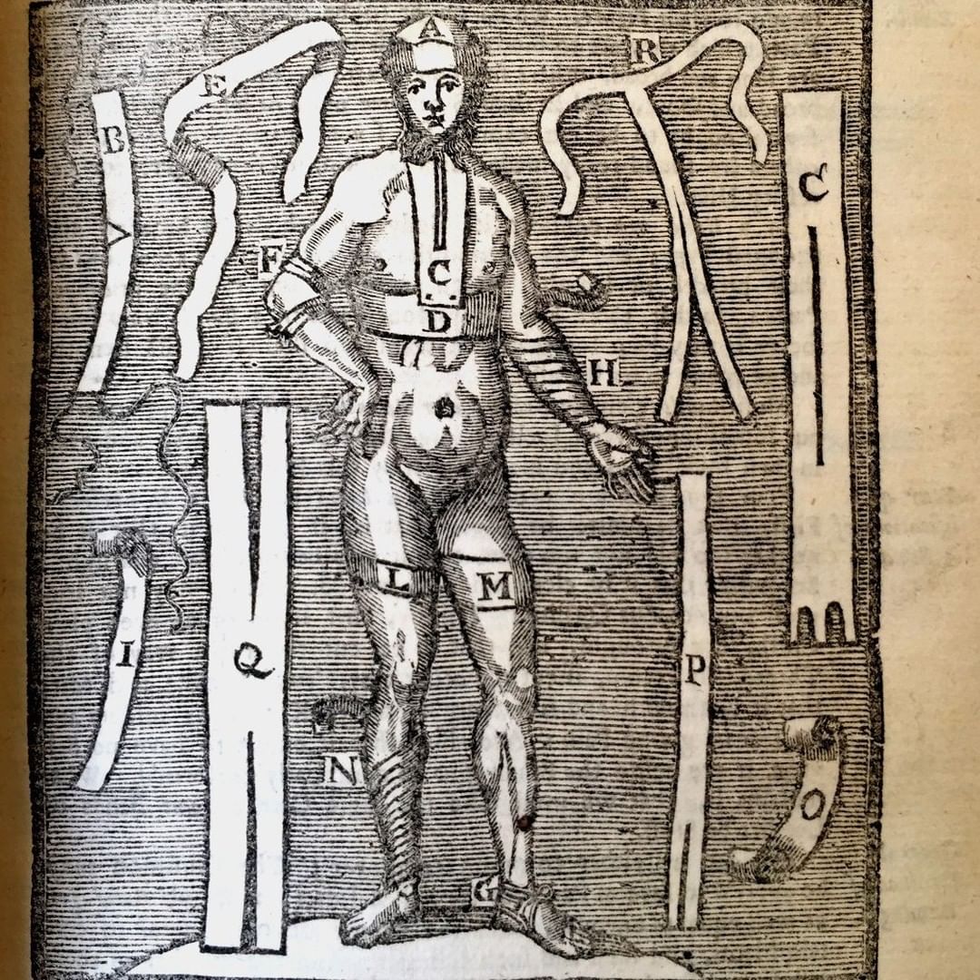 RCPEHeritage's tweet photo. A handy 1600s bandages guide – some leather, some linen, some flax. Different styles for different types of wounds and different body parts. And including compresses, pads and support stockings https://t.co/nXYyAokSEb