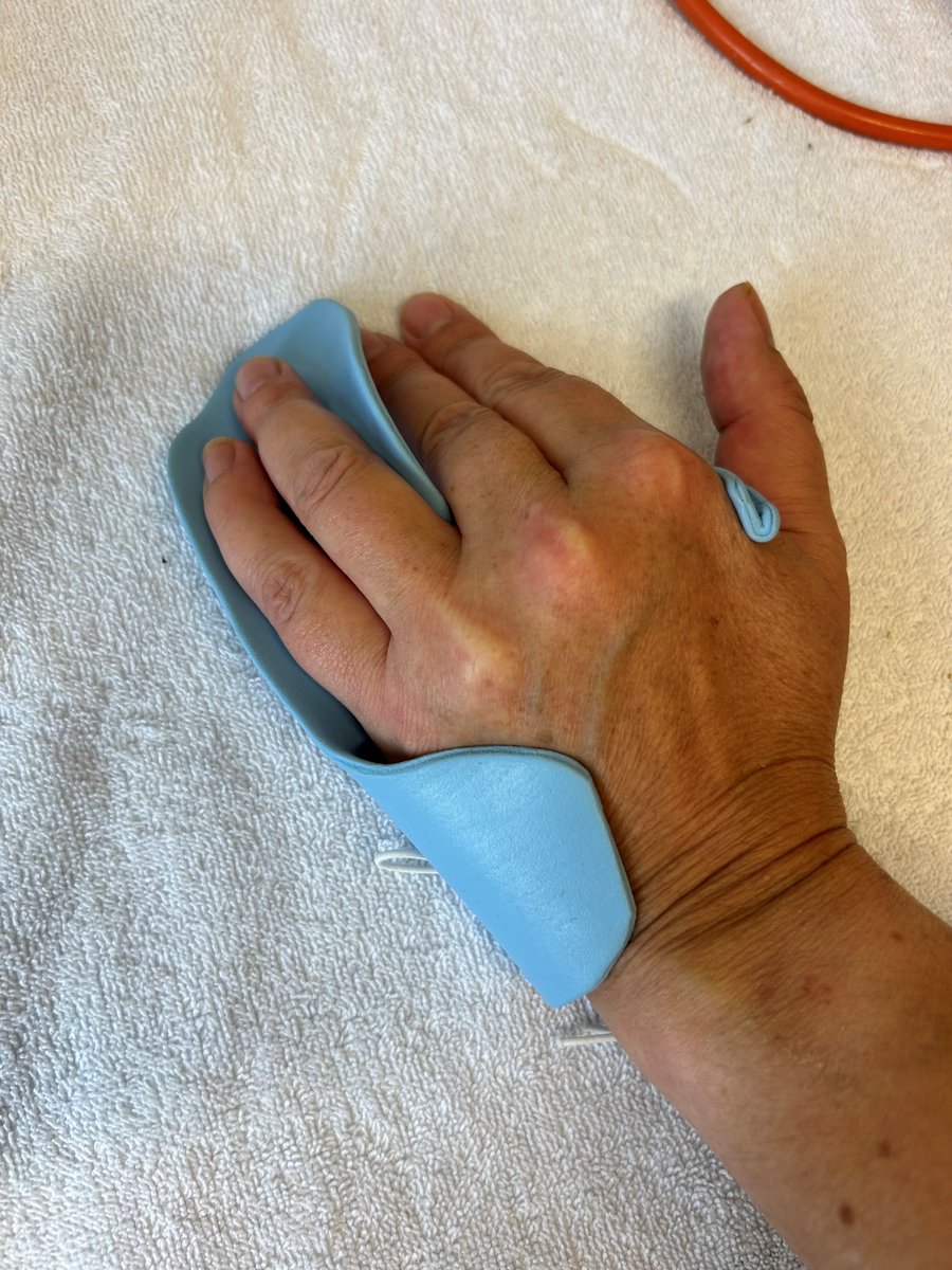 It’s #OTWeek and we’re celebrating the amazing care our Occupational Therapists provide all year round, helping people to overcome challenges and live their best lives.  Here’s some images of our OTs who work with hands in action. #OTWeek #OTWeek2024