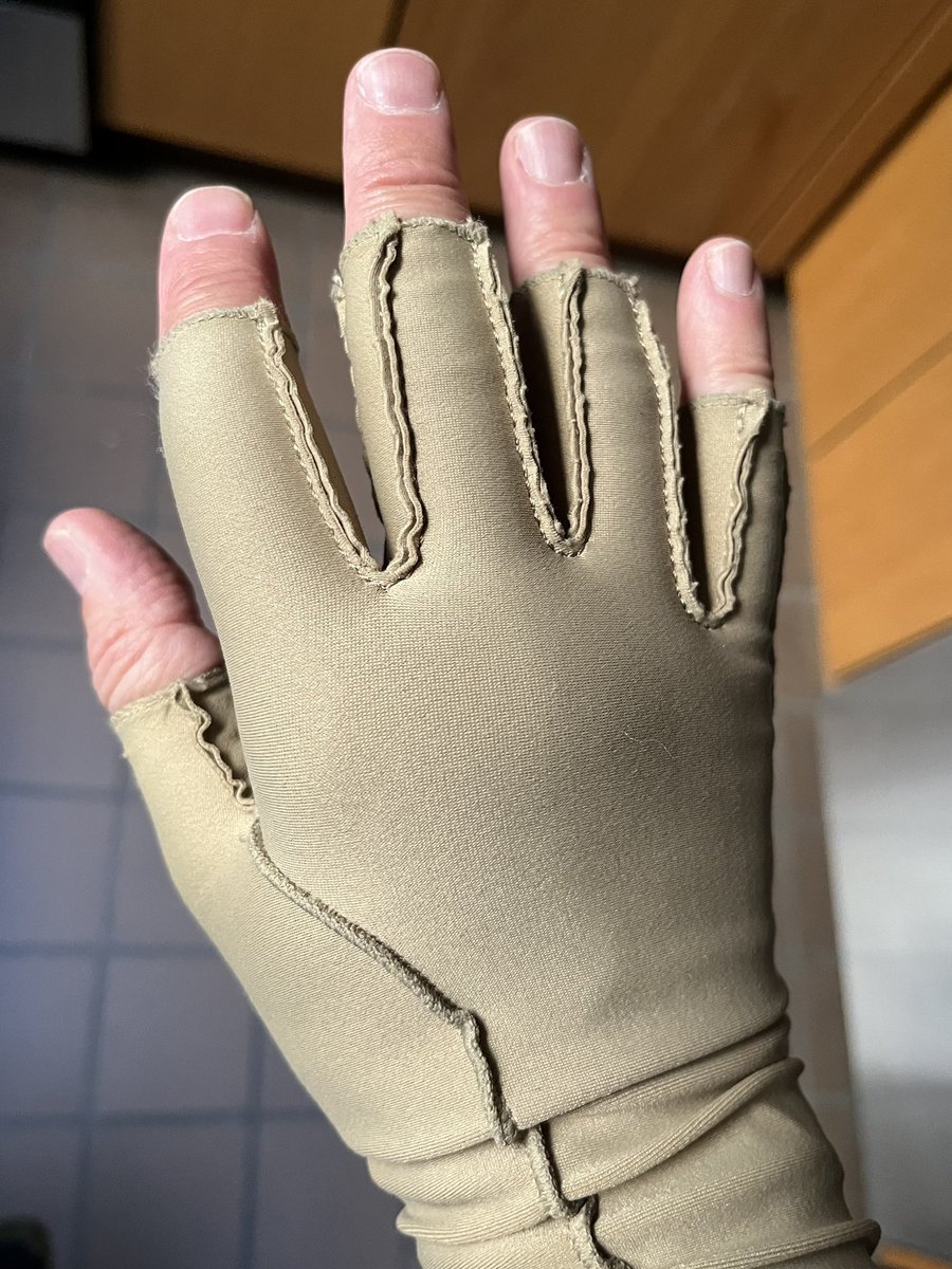 I was given this glove for my hand injury. It doesn't seem to have helped at all, but I'm going to start wearing it all the time because it allows me to avoid shaking hands with people, which is now unbelievably painful.