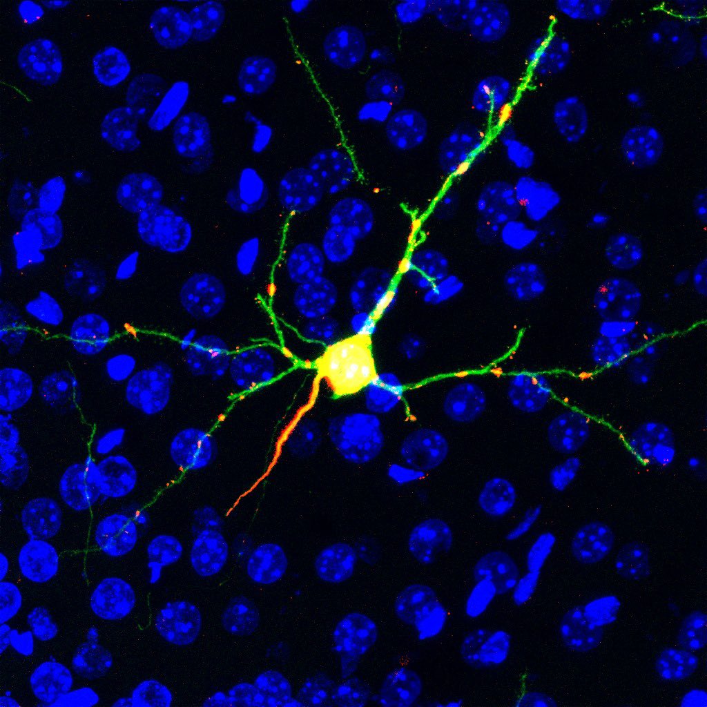 zmanjarres02's tweet photo. Do you feel as lonely as this cortical neuron positive to Synaptopodin? 

Synaptopodin is a protein enriched in the dendritic spines.

🔬LEICA SP8

🔴 Synaptopodin
🟢 EGFP
🔵 Hoescht https://t.co/PyhWt6cy1r