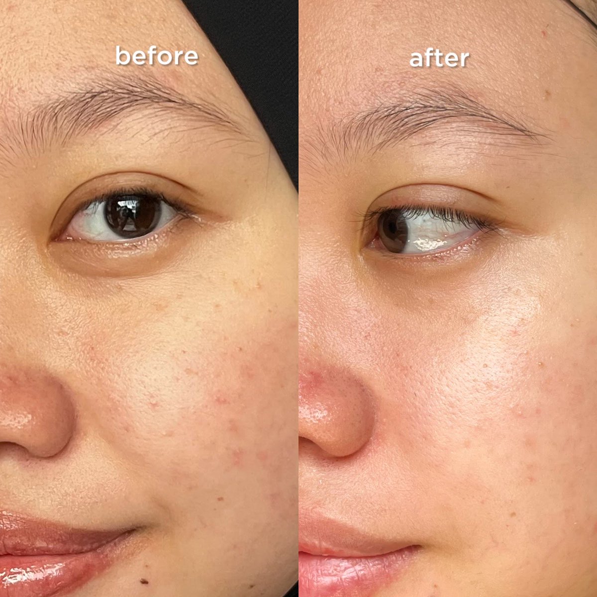 bakuchiollyc's tweet photo. Temasuk kaum yg menyesal karena baru cobain combo 2 produknya Hada Labo ini😭😭🙏🏻

Pake 2 step ini doang kulit lembabnya jadi aweett, alias jd super plumpy, halus, sehat😩☝🏻 https://t.co/z3LOqFYlEz