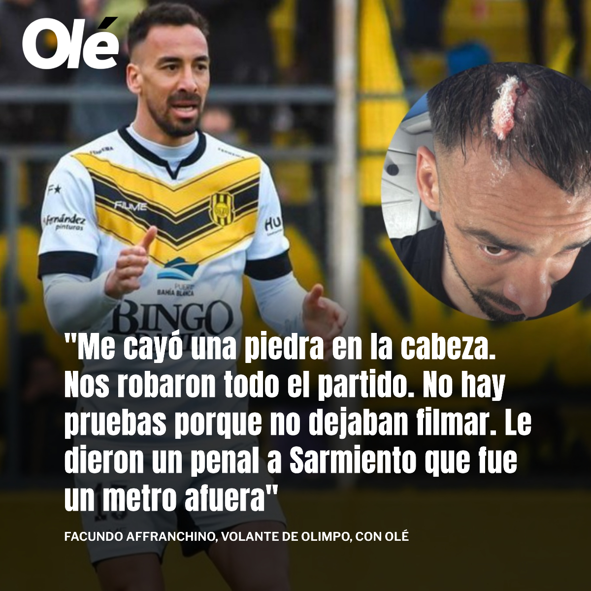 ⚠️🗣️ AFFRANCHINO, DE OLIMPO, FUE HERIDO Y DENUNCIÓ VS. SARMIENTO LA BANDA: "NOS ROBARON TODO EL PARTIDO"

🗞️ En su comunicación con Olé, tras el 1-1 que lo dejó al Aurinegro sin chances de ascender a la Primera Nacional, el volante declaró: 

"Nos robaron todo el partido. Se