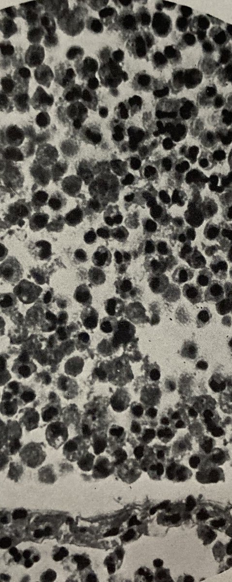 Rachel Lance💥 (@underwaterlance) on Twitter photo Did you know WILEY scientists used to bolt early cameras onto microscopes to study disease?
Learn about Wiley Forbus, pioneer of photomicroscopy, in my latest for <a href="/DukeU/">Duke University</a> #Duke100
100.duke.edu/story/wiley-fo…
Images are by Forbus in 1943, of diseases solved via imagery (see Alt Text) Did you know WILEY scientists used to bolt early cameras onto microscopes to study disease?
Learn about Wiley Forbus, pioneer of photomicroscopy, in my latest for <a href="/DukeU/">Duke University</a> #Duke100
100.duke.edu/story/wiley-fo…
Images are by Forbus in 1943, of diseases solved via imagery (see Alt Text)