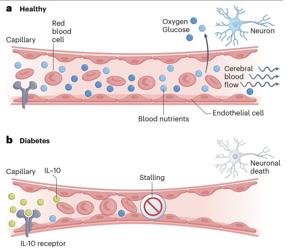 Eric Topol (@erictopol) on Twitter photo In diabetes, the capillary microvessels can become obstructed, leading to damage to neurons and cognitive deficits. A new mechanism elucidated involving interleukin-10 may help explain why
<a href="/NatMetabolism/">Nature Metabolism</a>
nature.com/articles/s4225…
<a href="/CraigEdBrown/">Craig E Brown</a> <a href="/MyUVic/">MyUVic-U of Victoria</a>
nature.com/articles/s4225… In diabetes, the capillary microvessels can become obstructed, leading to damage to neurons and cognitive deficits. A new mechanism elucidated involving interleukin-10 may help explain why
<a href="/NatMetabolism/">Nature Metabolism</a>
nature.com/articles/s4225…
<a href="/CraigEdBrown/">Craig E Brown</a> <a href="/MyUVic/">MyUVic-U of Victoria</a>
nature.com/articles/s4225…