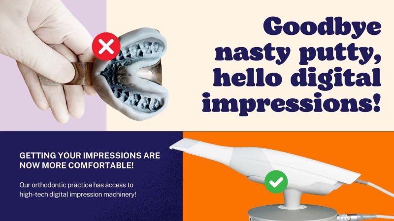 DrLewSample's tweet image. Digital impressions are here to stay 💁‍♀️

#valleyorthodontics #drlauren #drsample #hartselleal #hartselleorthodontists