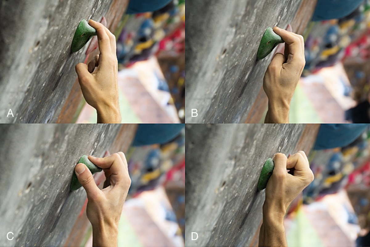 Current Sports Medicine Reports (@csmronline) on Twitter photo New case series: clinical manifestation of ulnar nerve entrapment and compression in patients with initially misdiagnosed & mismanaged elbow tendinopathy + clinical recommendations to accurately identify & manage upper extremity climbing injuries. 🧗 brnw.ch/21wOmFy New case series: clinical manifestation of ulnar nerve entrapment and compression in patients with initially misdiagnosed & mismanaged elbow tendinopathy + clinical recommendations to accurately identify & manage upper extremity climbing injuries. 🧗 brnw.ch/21wOmFy