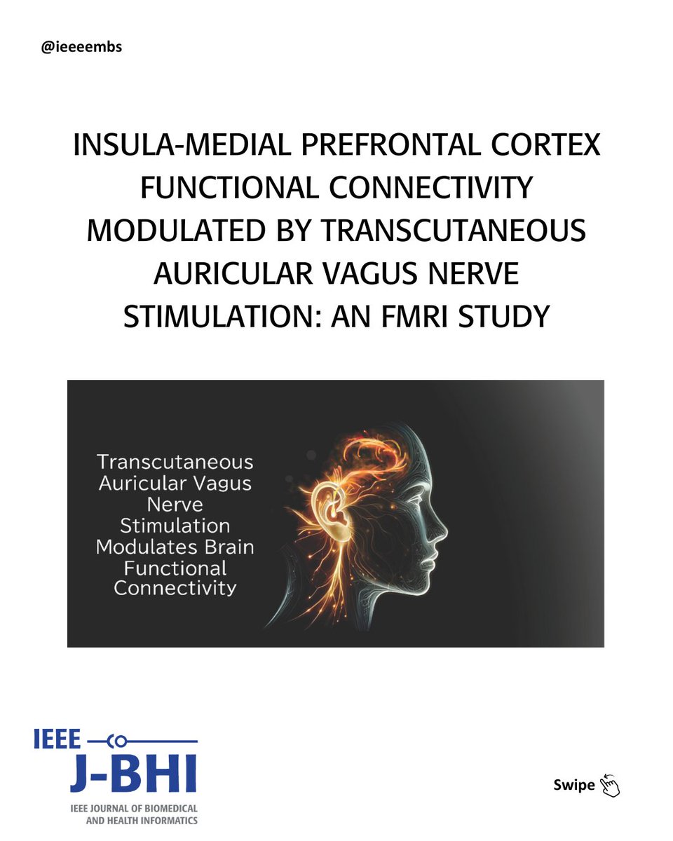 🚀 Exciting research alert! JBHI's October article highlights feature innovative work on eating speed measurement using wrist-worn IMU sensors and more! Don't miss out! 🍽📊 #NutritionScience #WearableTech #HealthTech #BiomedicalResearch
🔗 Discover more: embs.org/jbhi/articles/…