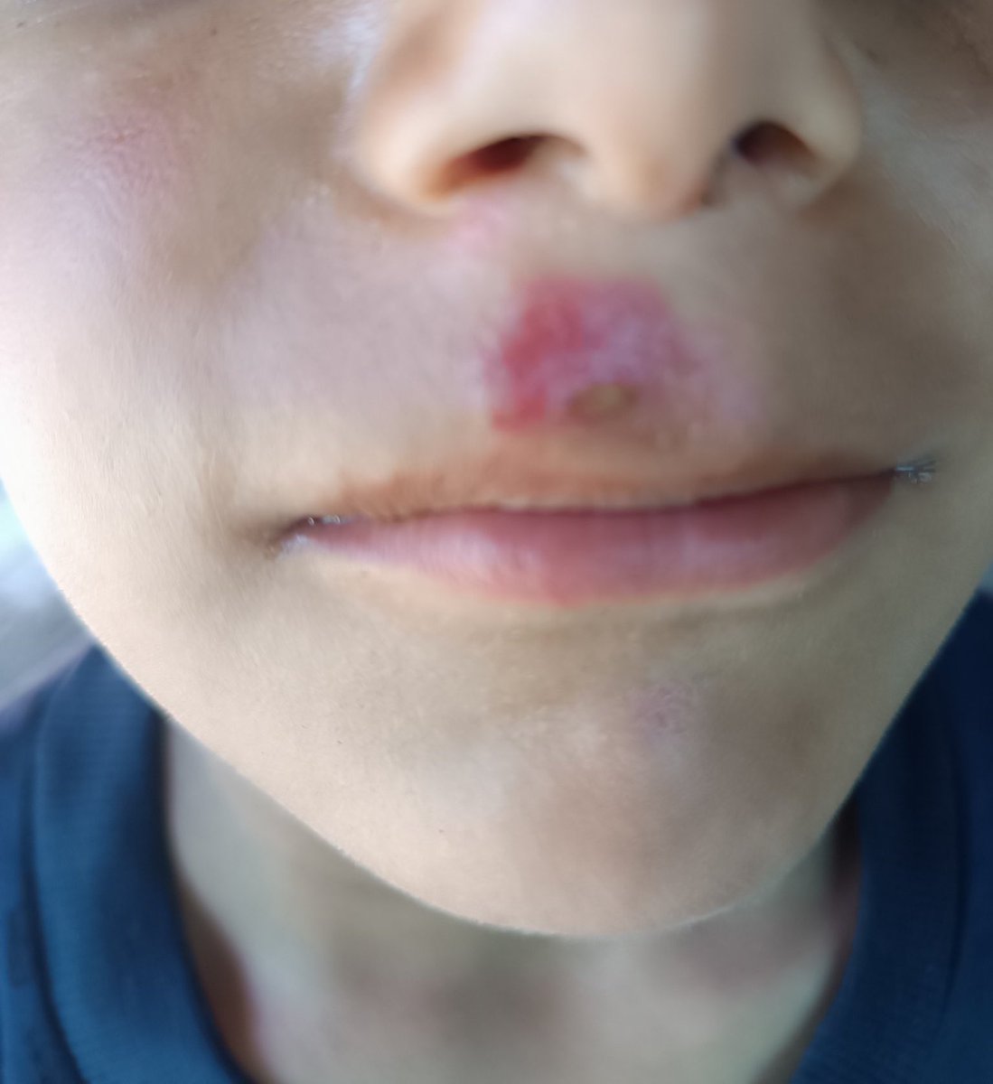 liliaaade's tweet photo. La famille de Yousef souffre énormément, les enfants de sa famille sont touchés par de sérieux problèmes cutanés dus à la pollution de l’air et de l’eau. 

Svp faites des dons c’est vital pour eux. 

https://t.co/FBvgNcxaZH https://t.co/W73Y96PO92