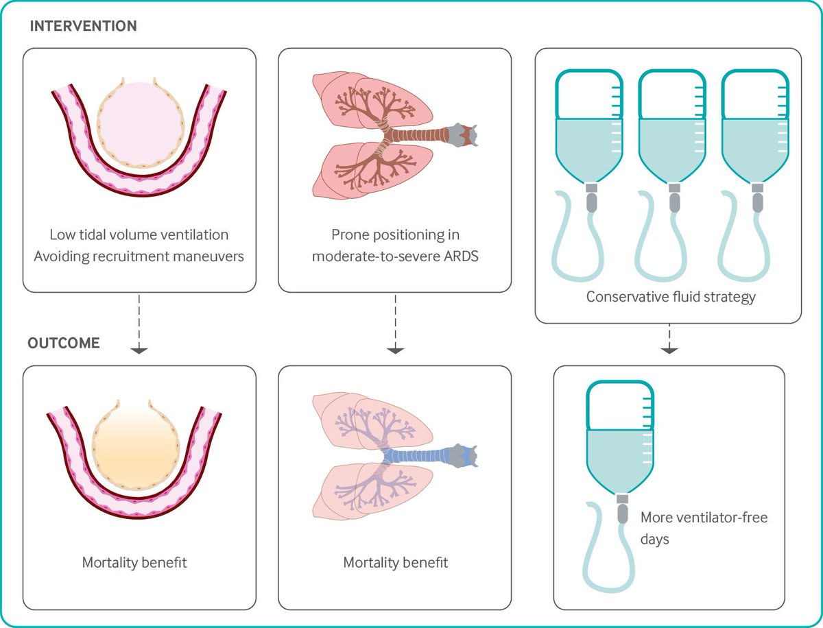 CritCareReviews's tweet photo. Acute respiratory distress syndrome - State of the Art Review

CCR Journal Watch
https://t.co/Sp06oA6IDG

Get the latest critical care literature every weekend via the CCR Newsletter - subscribe at https://t.co/nitMzacLrj https://t.co/Pu8Dq6LNCh