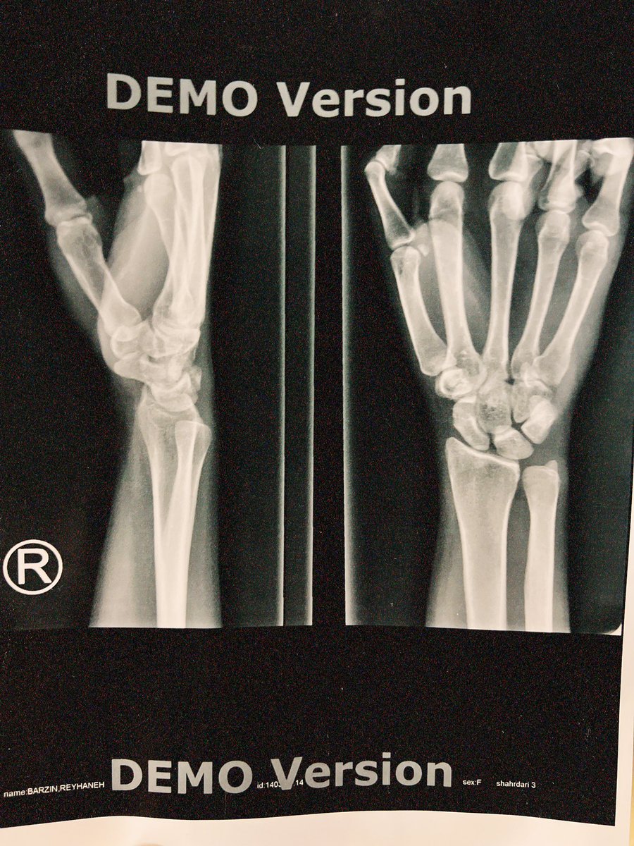 _reyhb_'s tweet photo. 🌆🌃
my poor strong hand 🪄 https://t.co/ttgnABqLXx