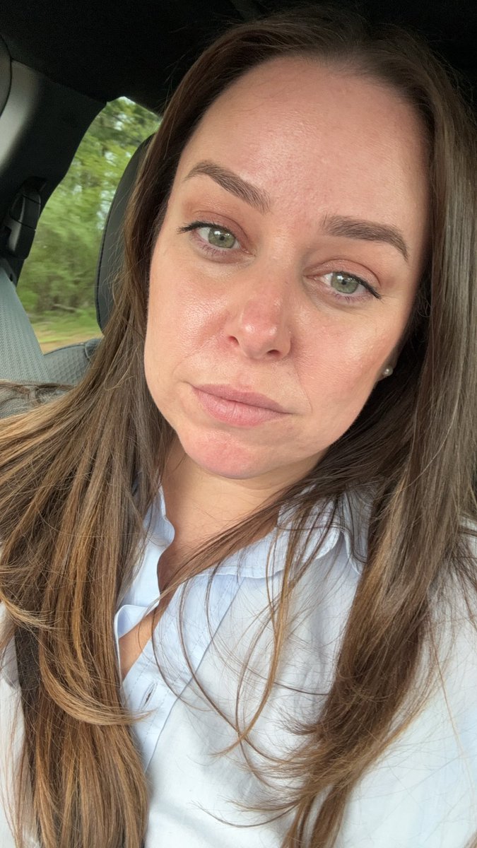 MegCFitz's tweet photo. @CilComLFC @Wejolyn My derm prescribed it to me after trying every topical and nothing would work. Changed my skin so quickly. Apparently insurance won’t cover the actual prescription unless trying every other topical first. You can see how miserable and uncomfortable I am in the first pic https://t.co/V0GgDVvd1D