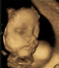 brandmania's tweet photo. My #1 extra reason for defeating aging (from the two very good ones I already have 🤭).
I need to see some grand children out of this new venture 😜 should be out by February 10th next year.
Should take around another 30 years.
#defeataging #longevity #babypics https://t.co/DmboBORAlj