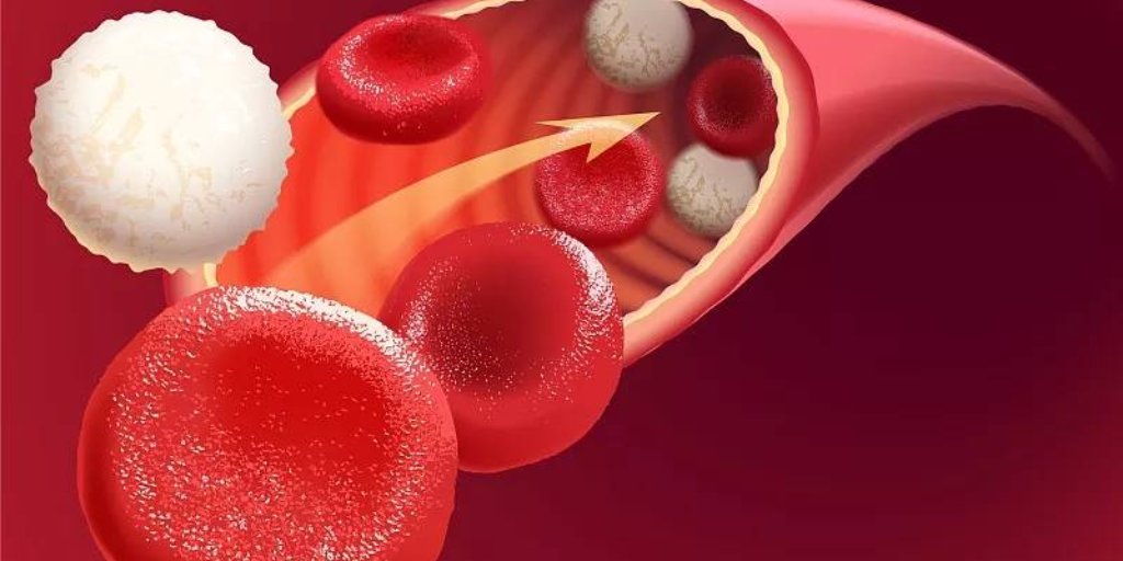HainanJournal's tweet photo. Blood markers LDH, sIL-2R, and GDF15 can effectively predict recovery outcomes in children with leukemia after stem cell transplants！
#leukemia #children #cell #transplants 
@HainanJournal 
https://t.co/YkcaGQR7kQ https://t.co/xGYp5pJI6Y