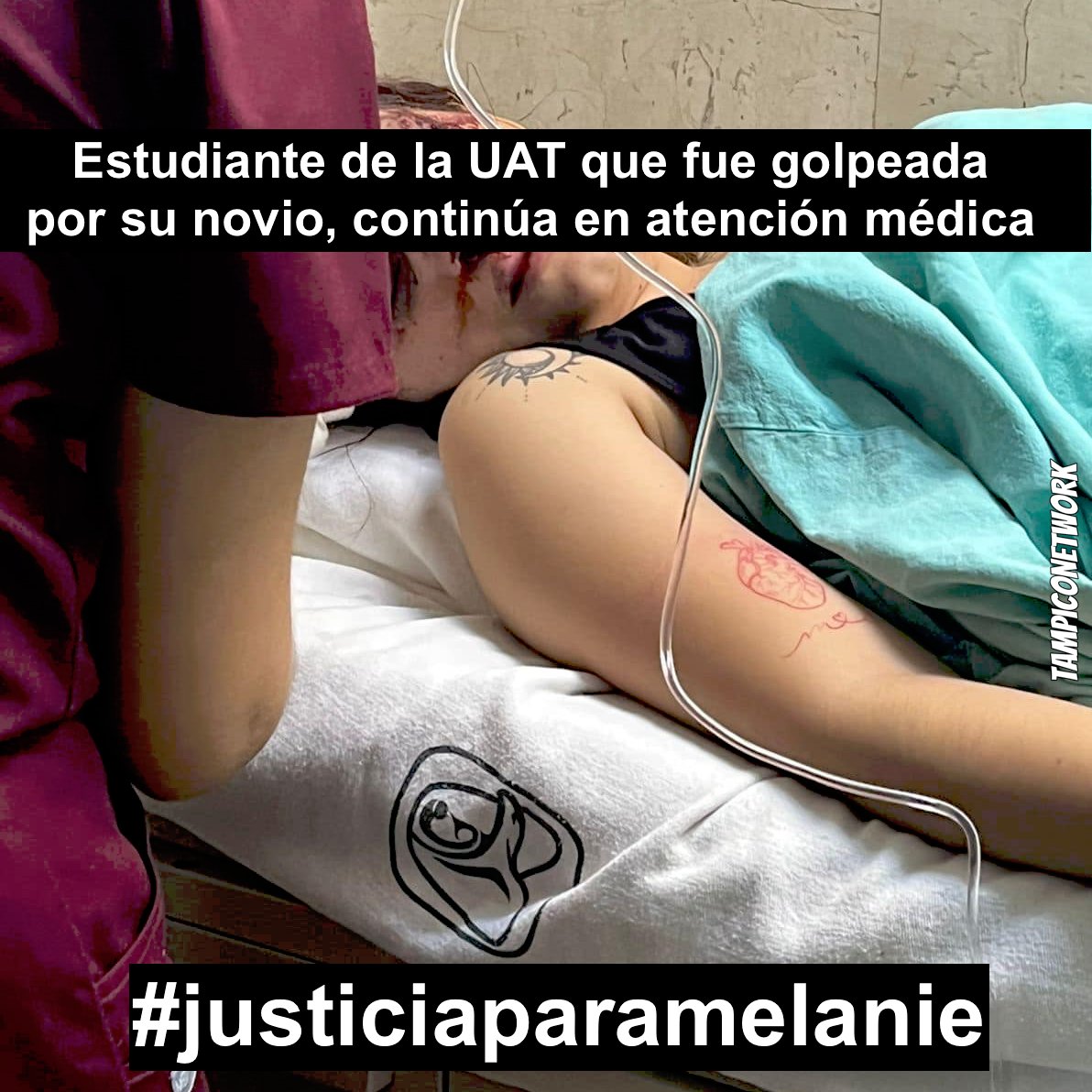 Tampico_Mexico's tweet photo. El huachicolero Erasmo González Robledo, no ha ayudado a Melanie, la estudiante de la UAT que su novio la golpeó hasta reventarle el ojo en Ciudad Madero @erasmoglz chapulin del PRI a @PartidoMorenaMx No le interesa ayudar #justiciaparamelanie @Dr_AVillarreal FALSOS HUMANISTAS https://t.co/AuBjKzF1Ee