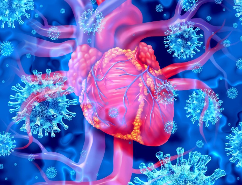 🚨⚠️ Heart attacks🫀in people under 40 have risen 66% since the beginning of the COVID pandemic. COVID is a vascular disease

COVID can affect the cardiovascular system by increasing blood stickiness, which raises the likelihood of blood clot formation.