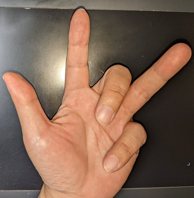 ãã°ã¯ã·ããã©ãããŠãå®çŸããããŠ
çžåœã«ç·Žç¿(?)ããŠ
ãªããšãå·Šæã¯åºæ¥ãããã«ãªããŸãã
楳å³å
çã®äœåæ¬åœã«å€§å¥œãã§ããâŠ
ã°ã¯ã·!
ãããŠ
ãµãã©!