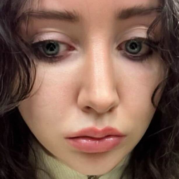 RecessedChin's tweet image. #NewProfilePic