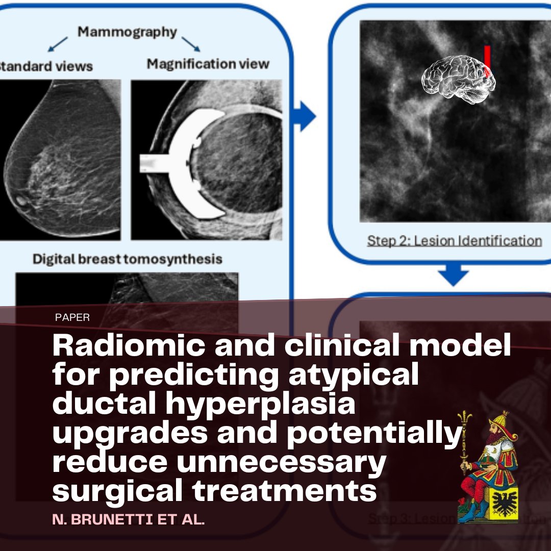 🚀Exciting News from Our Lab!
Thrilled for two new pubished papers on the analysis of oncological data

1️⃣ Localized FDG Loss in Lung Cancer Lesions ejnmmires.springeropen.com/articles/10.11…

2️⃣ Radiomic and Clinical Model for Predicting Atypical Ductal Hyperplasia Upgrades
doi.org/10.1016/j.ejra…