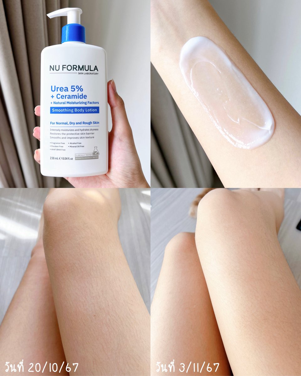 moonmoonreview's tweet image. ตัวนี้เเหละคือที่สุดของคนผิวตัวเเห้ง คือบอกก่อนว่าสต.เราอยู่ห้องเเอร์ตลอด เเล้วเพิ่งว่ารู้สึกว่าผิวเเห้งมากก็ตอนเพื่อนทักมันเเห้งจนเป็นขุยขาวเลยอายมากก ด้วยความที่ไม่ชอบความเหนอะตัว เลยละเลยเเบบสุดๆ เเล้วเราก็หาจนเจอ #โลชั่นNUกู้ผิวแห้ง…