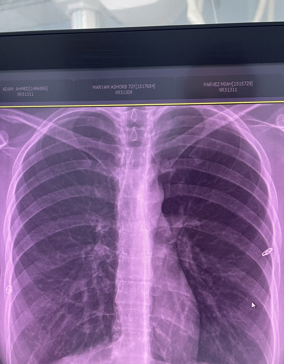 itssemmys's tweet photo. Did u know I have a beautiful ribs? A little peek inside🩻👀 https://t.co/0raFbvWipi