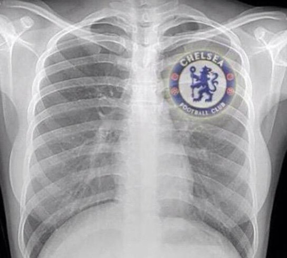 TheChelseaForum's tweet image. I believe in the Chelsea community and all our members 💯💙