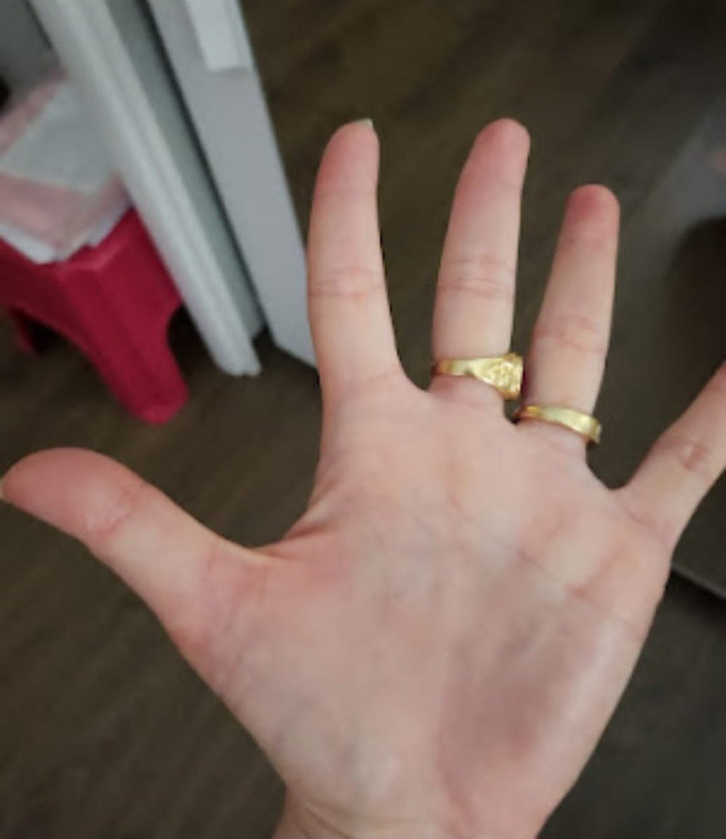 lauracaro989's tweet photo. Las manos son nuestro primer contacto con el mundo, esas compañeras fieles que hablan sin palabras. 🤲 Son las que nos sostienen cuando todo tiembla.

¿Pero qué pasa cuando algo tan indispensable está en juego? 

#Manos  #Batallas #lachicadelaparadamental #SaludNeurológica #hand https://t.co/sVJ0Yr3qaT
