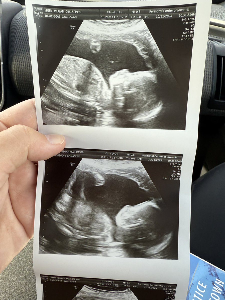 PrezWhitehouse's tweet photo. Please vote. Vote for your daughters, sisters, wives, friends, and neighbors. Vote for a better society, not fueled by hate. After today my wife and I may be unable to continue growing our family. Not safely. Please vote for Harris. https://t.co/1Ho4shehF2